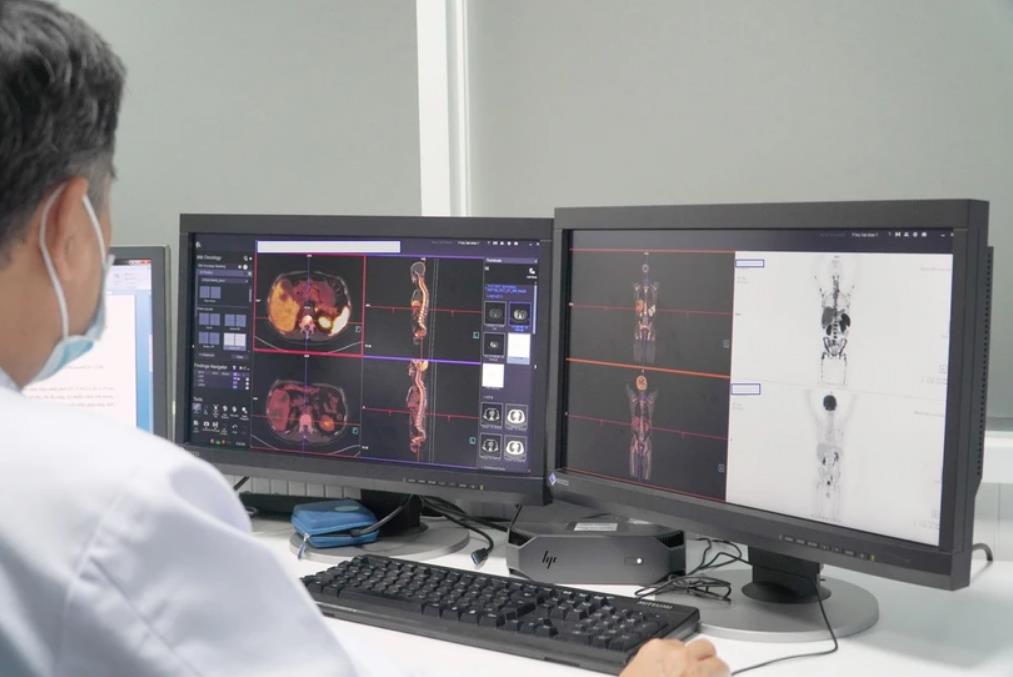 Hình ảnh chụp PET/CT của bệnh nhân tại Bệnh viện Chợ Rẫy TP Hồ Chí Minh.