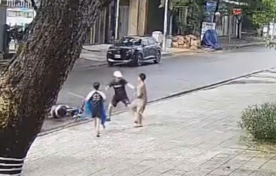 Vết bầm trên chân cháu bé sau vụ việc