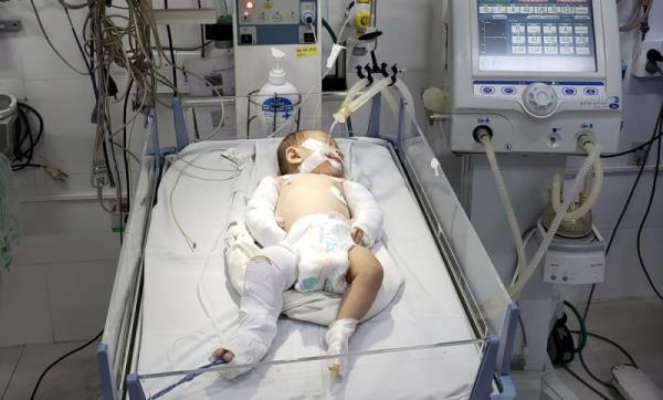 Nghi án trẻ bị bạo hành