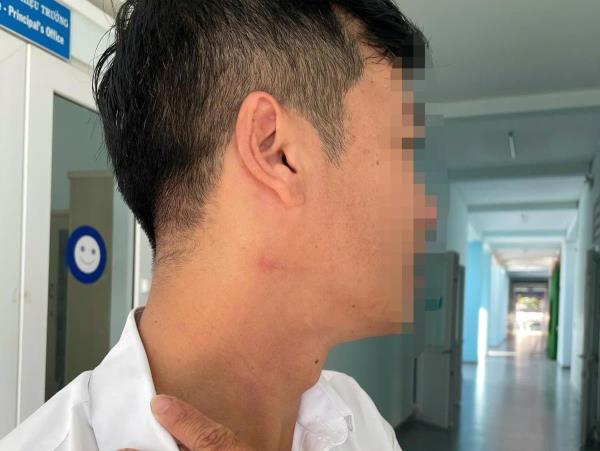 Thầy giáo bị đồng nghiệp bóp cổ giữa sân trường vì nhắc đỗ xe sai quy định