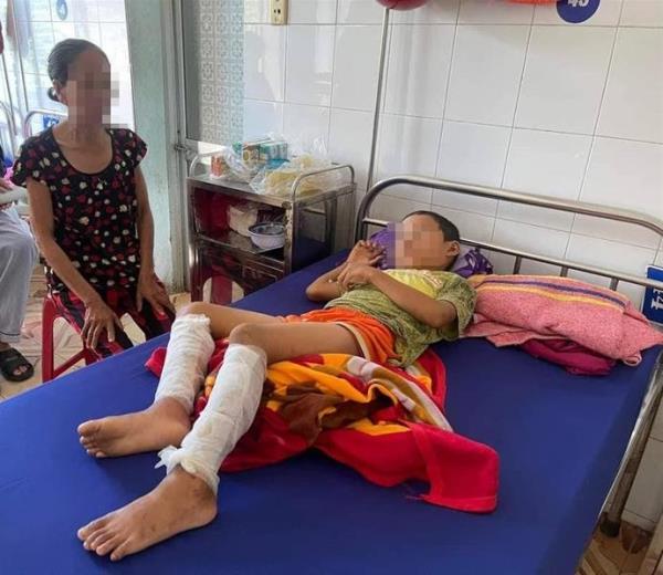 Cha dùng xăng đốt con trai