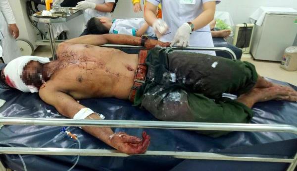 Lý giải nguyên nhân người đàn ông bị gấu rừng tấn công